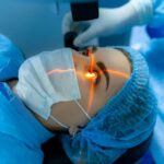 surgery lasik